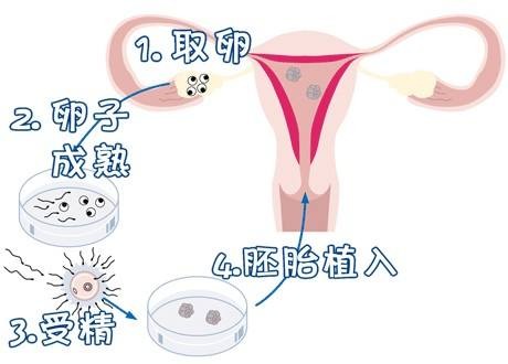 关于供卵代生咨询服务